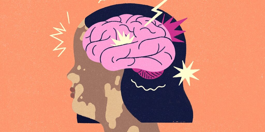 Here’s How Vitiligo Can Affect Your Mental Health, From People Who Get It