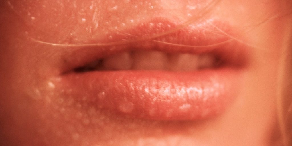 What Causes Excessive Face Sweat, and How Can I Stop It?