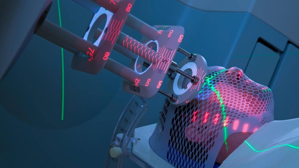 Mayo Clinic Minute: Breaking through radiation therapy myths