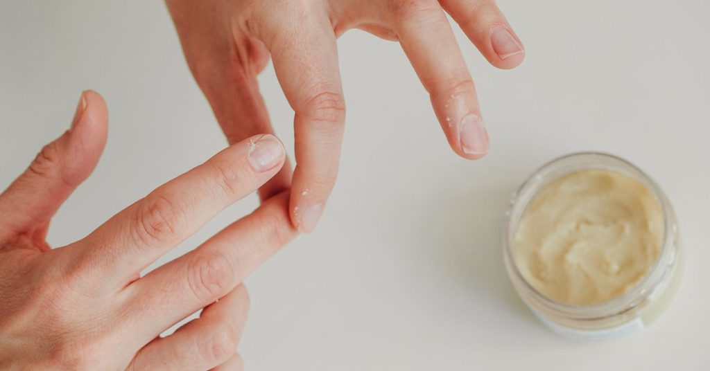 Can Alopecia Areata Affect Your Nails?