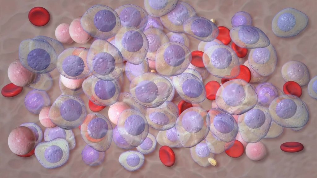 Mayo Clinic Minute: Advances in multiple myeloma treatment