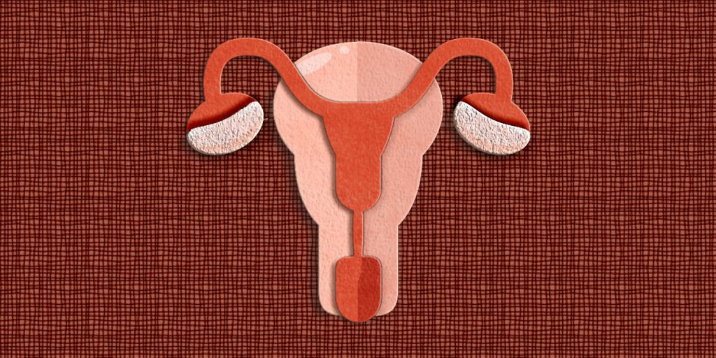 5 Signs of PCOS You Might Be Mistaking for Something Else