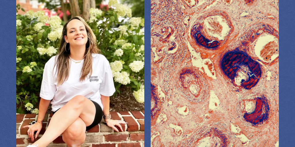 I Was Told I Had an STI. It Was Actually Cervical Cancer