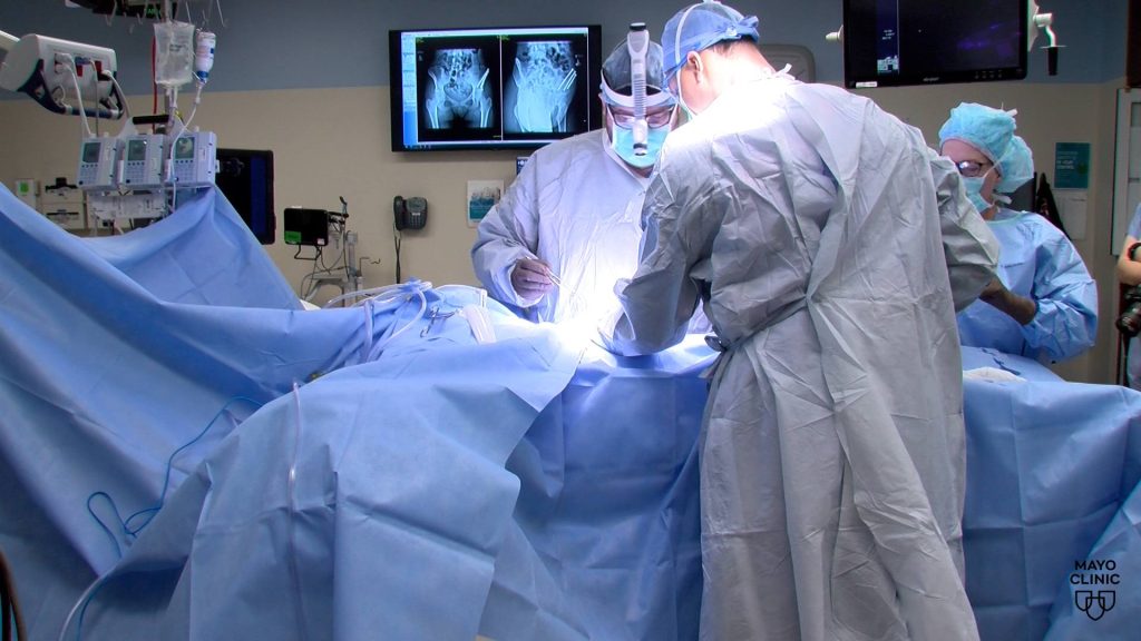 Mayo Clinic Minute: What is hip preservation?