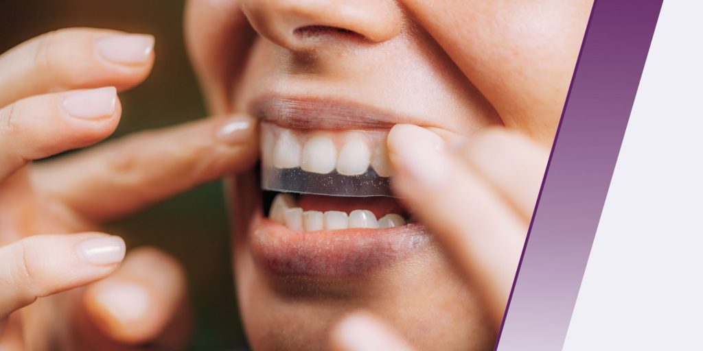 5 Teeth Whitening Strips From $8 During Amazon's Spring Sale