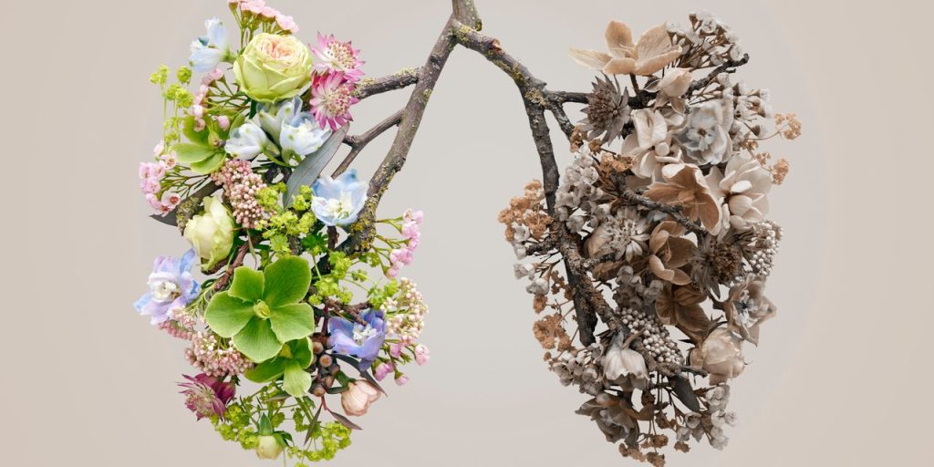 Lung Cancer In Women Is Often Overlooked. Here Are the Symptoms You Should Know Lung Cancer In Women Is Often Overlooked. Here Are the Symptoms You Should Know